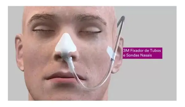 Fixador Para Tubos E Sondas Nasais Com 1 Unidade – 3M - Image 2