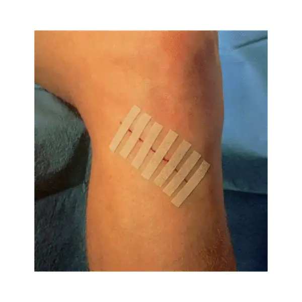 Curativo Ponto Falso Com 12 Tiras Skin-Strip - Imagem 3
